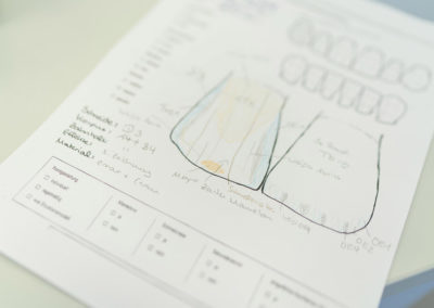 Detaillierte Skizze zur Herstellung von Zahnersatz